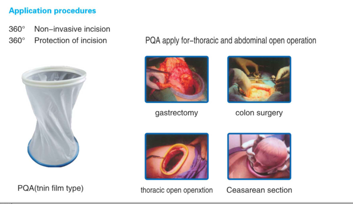 Disposable Incision Protector application
