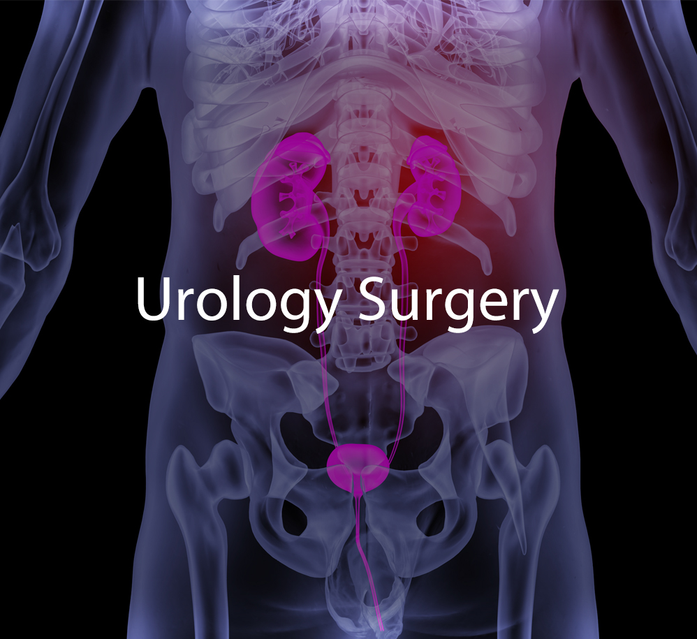 Urology Surgery